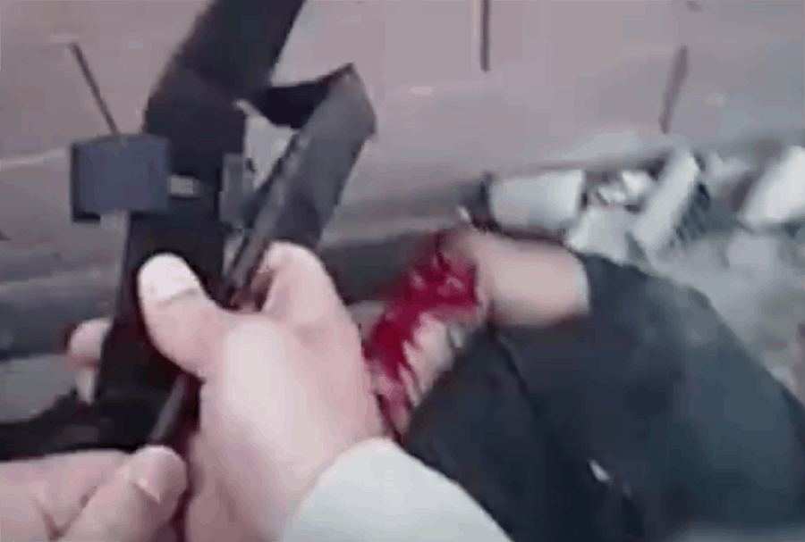 Injured individual after an OIS.