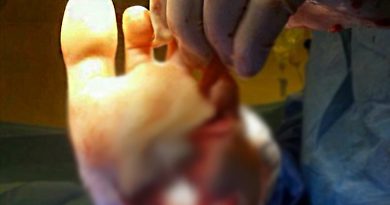 Resting a muzzle on your foot is a Bad Thing.